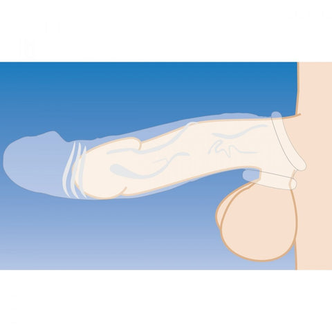 Size Matters 2 Inch Clear Penis Extender Sleeve > Sex Toys For Men > Penis Sleeves